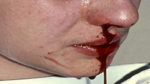 sangue-dal-naso